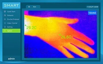 thermal imaging function