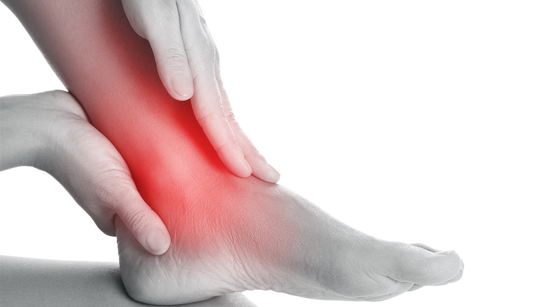 Fast-Tracking Healing Laser Therapy Offers Hope for Achilles Tendonitis Sufferers