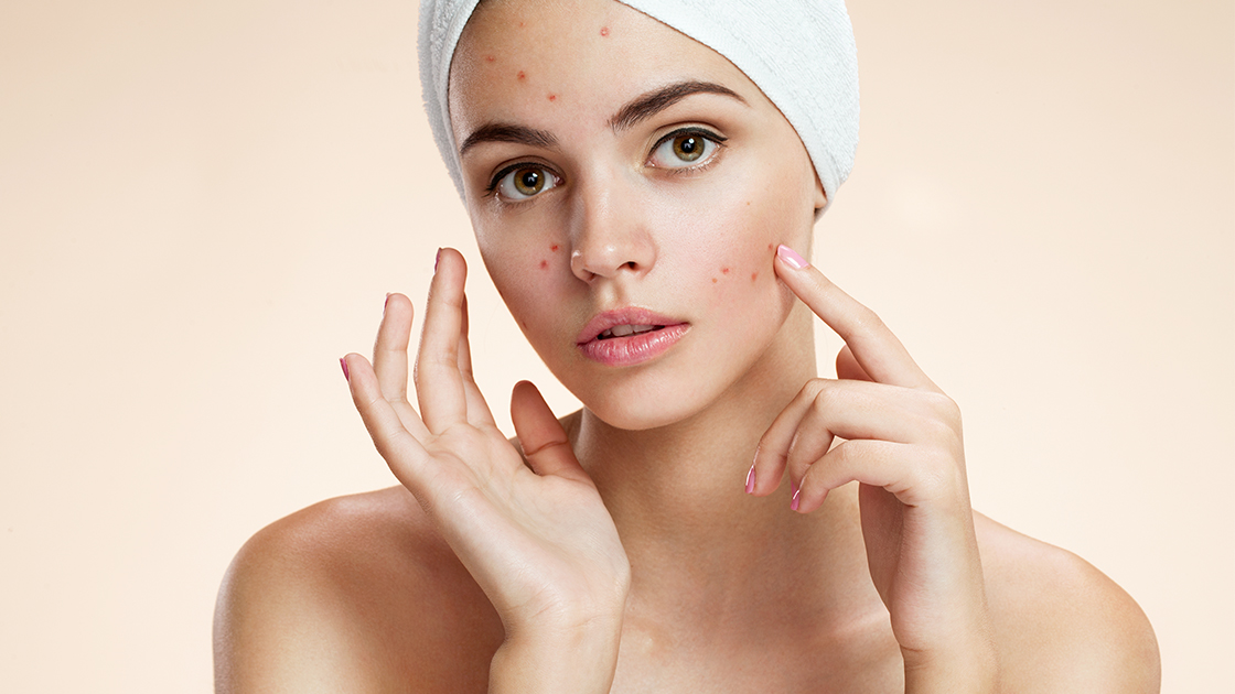 Unmasking Beauty The Benefits of Laser Acne Treatment
