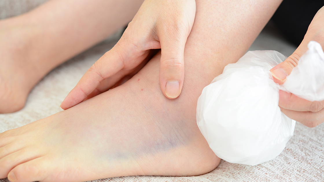 Laser Therapy Shines in Ankle Sprain Relief